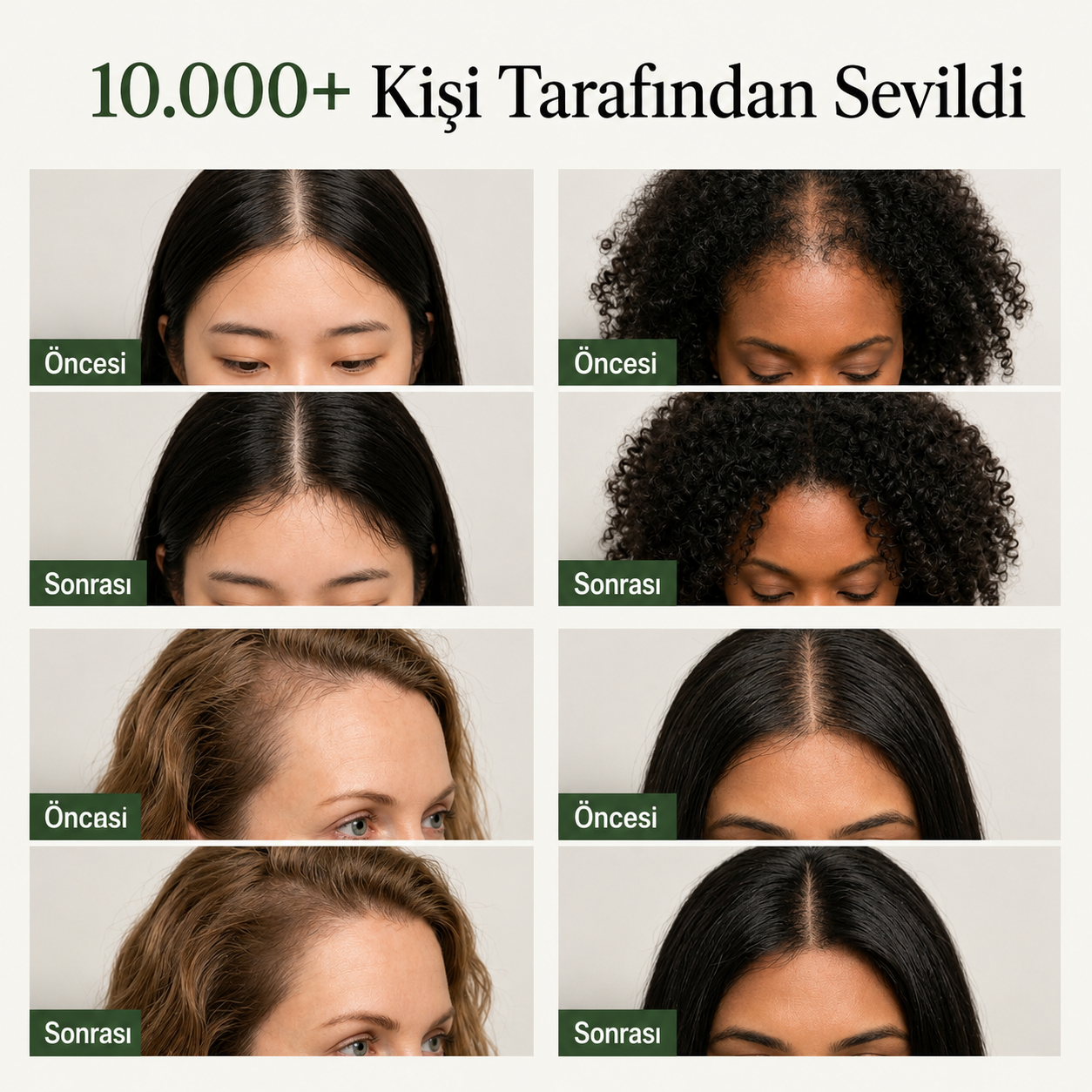 Naturacare™- Kore Saç Derisi Yenileme Barı